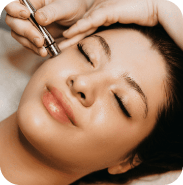 Microagulhamento - Harmonização Facial em Campinas