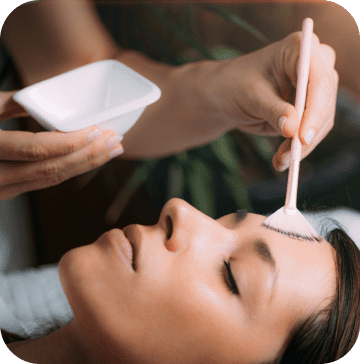 Peeling em Campinas - Harmonização Facial